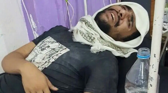 شاهد.. صور صادمة لصحفي يمني تعرض للتعذيب الشديد من قبل مليشيات الامارات